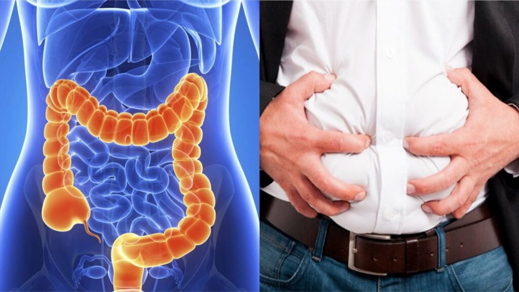 3 Cách Đơn Giản để Ngăn Ngừa Ung Thư Ruột Kết