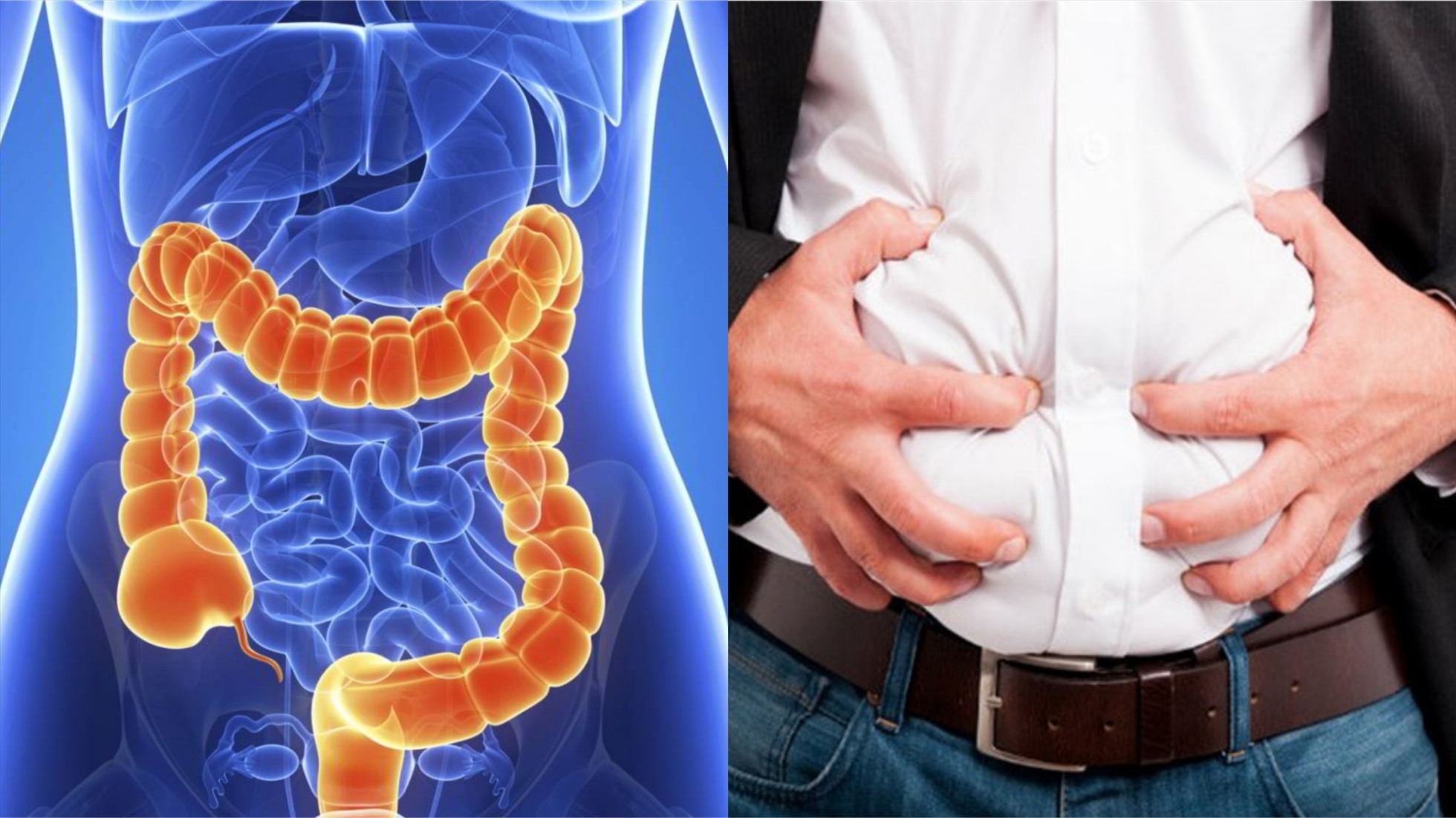 3 Cách Đơn Giản để Ngăn Ngừa Ung Thư Ruột Kết